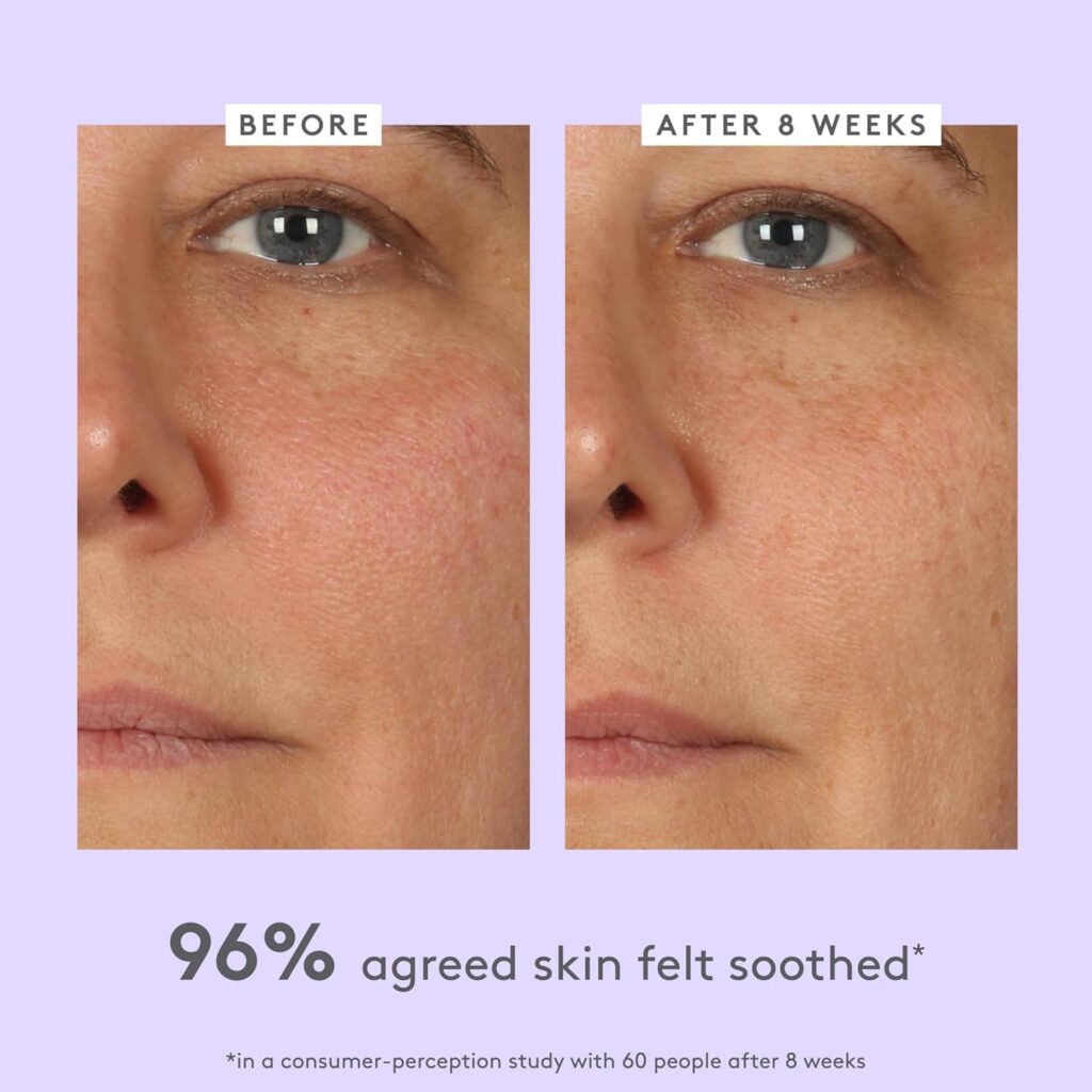 Unlocking Hydration: Your Ultimate Guide to the Best Moisturizer for Dry Skin 10 dry skin