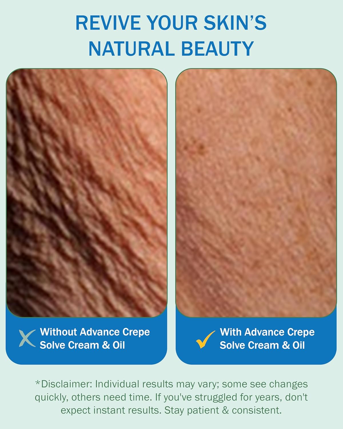 1761231491_Crepe-Cream-for-Aging-Skin-Women-Men-2-Pack-with-Natural-Oils-Licorice-Root-Chamomile-Extract-Crepey-Skin-Tightening-Cream-for-Body-4-fl-oz-Made-in-USA.jpg 1761231491 Crepe Cream for Aging Skin Women Men 2 Pack with Natural Oils Licorice Root Chamomile Extract Crepey Skin Tightening Cream for Body 4 fl oz Made in USA