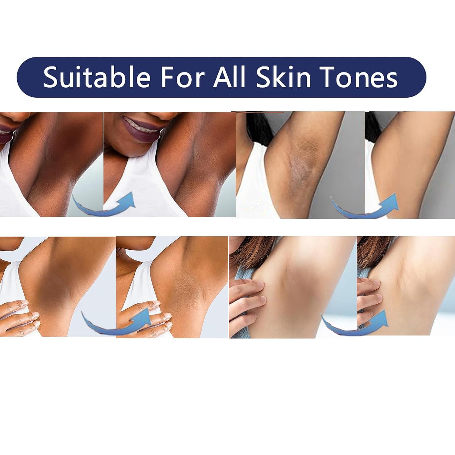1761872291_Skin-Lightening-Cream-Gel-For-Body-Intimate-Area-With-Niacinamide-Arbutin-Vitamin-C-For-Private-Parts-Underarm-Knees-Elbows-Inner-Thigh-Bikini-Areas-armpit-Skin-Whitening-Bleaching-Cream-30ML.jpg 1761872291 Skin Lightening Cream Gel For Body Intimate Area With Niacinamide Arbutin Vitamin C For Private Parts Underarm Knees Elbows Inner Thigh Bikini Areas armpit Skin Whitening Bleaching Cream 30ML