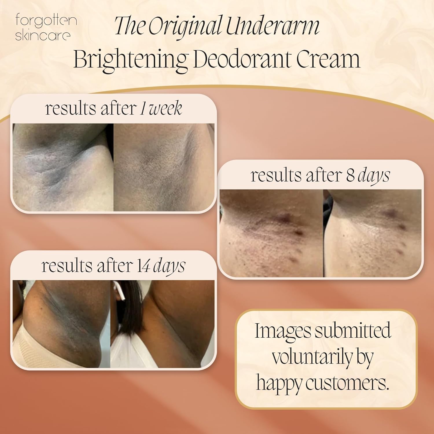 1761965890_Forgotten-Skincare-The-Original-Underarm-Brightening-Deodorant-Cream-For-Dark-Underarms-Treatment-Body-Odor-Eliminator-For-Women-Men-Ingrown-Hair-Treatment-Vitamin-C-Salicylic-Acid.jpg 1761965890 Forgotten Skincare The Original Underarm Brightening Deodorant Cream For Dark Underarms Treatment Body Odor Eliminator For Women Men Ingrown Hair Treatment Vitamin C Salicylic Acid