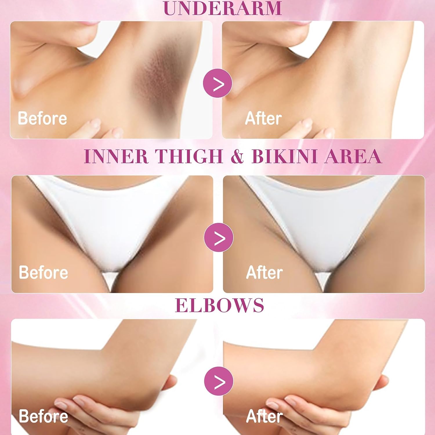 1762034291_Skin-Lightening-Cream-Dark-Spots-Remover-for-Body-Even-Toning-Effectively-Whitening-Women-Intimate-Areas-Bikini-Line-Underarms-Knees-Elbows-Renew-Complexion-and-Replenish-Skin-Barrier.jpg 1762034291 Skin Lightening Cream Dark Spots Remover for Body Even Toning Effectively Whitening Women Intimate Areas Bikini Line Underarms Knees Elbows Renew Complexion and Replenish Skin Barrier